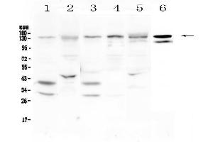 Western blot analysis of EPS15 using anti-EPS15 antibody . (EPS15 抗体  (AA 2-88))