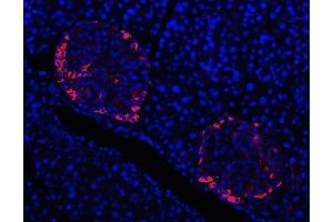 IF analysis of Prealbumin using anti-Prealbumin antibody (ABIN3042346).