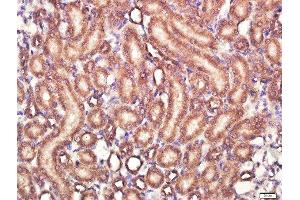 Paraformaldehyde-fixed, paraffin embedded rat kidney tissue, Antigen retrieval by boiling in sodium citrate buffer(pH6) for 15min, Block endogenous peroxidase by 3% hydrogen peroxide for 30 minutes, Blocking buffer (normal goat serum) at 37°C for 20min, Antibody incubation with IL-4I1 Polyclonal Antibody, Unconjugated  at 1:400 overnight at 4°C, followed by a conjugated secondary and DAB staining (IL4I1 抗体  (AA 51-160))