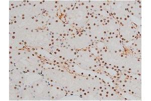 Immunohistochemistry (IHC) image for anti-Activating Transcription Factor 2 (ATF2) (pThr51), (pThr69) antibody (ABIN6256594)