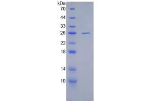 SDS-PAGE analysis of Human cPLA2 Protein. (PLA2G4A 蛋白)