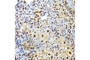 Immunohistochemistry (IHC) image for anti-Solute Carrier Family 29 (Nucleoside Transporters), Member 2 (SLC29A2) antibody (ABIN7270448)
