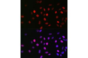Immunofluorescence analysis of U2OS cells using Acetyl-Histone H3-K23 Rabbit mAb (ABIN3016647, ABIN3016648, ABIN3016649, ABIN1681125 and ABIN1681126) at dilution of 1:100 (40x lens).