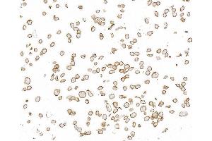 Immunocytochemistry (ICC) image for anti-Thrombomodulin (THBD) (AA 17-515) antibody (ABIN7795644)