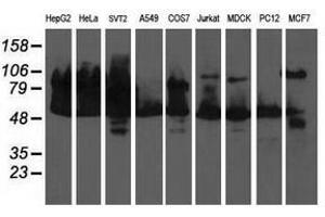 Image no. 2 for anti-Dihydrolipoamide Dehydrogenase (DLD) antibody (ABIN1497850) (DLD 抗体)