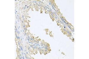 Immunohistochemistry of paraffin-embedded human prostate using PPP3R1 antibody. (PPP3R1 抗体  (AA 11-170))