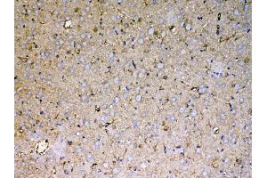 IHC analysis of Sacsin using anti-Sacsin antibody . (Sacsin 抗体  (AA 3709-3909))
