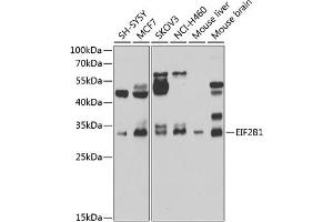 Western blot analysis of extracts of various cell lines, using EIF2B1 antibody (ABIN6132115, ABIN6140035, ABIN6140036 and ABIN6223878) at 1:1000 dilution. (EIF2B1 抗体  (AA 1-305))