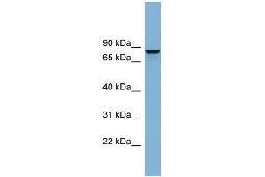 WB Suggested Anti-GGA3 Antibody Titration: 0. (GGA3 抗体  (N-Term))
