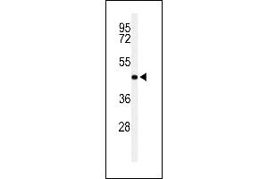 RPRD1B 抗体  (C-Term)