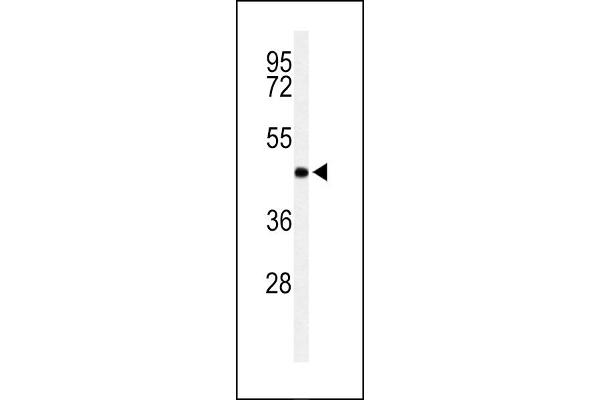 RPRD1B 抗体  (C-Term)