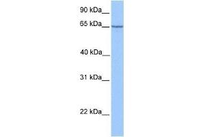 Western Blot showing PML antibody used at a concentration of 1. (PML 抗体  (C-Term))