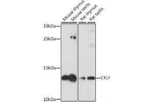 Western blot analysis of extracts of various cell lines using CKLF Polyclonal Antibody at dilution of 1:1000. (CKLF 抗体)