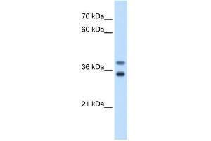 GDE1 antibody used at 0. (GDE1 抗体  (N-Term))