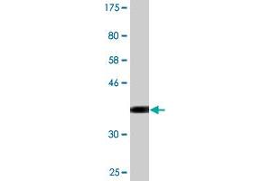 Western Blot detection against Immunogen (37. (Cyclin T2 抗体  (AA 264-370))