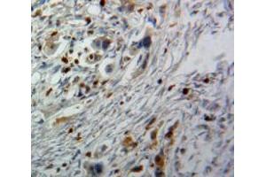 IHC-P analysis of Pancreas tissue, with DAB staining. (CDK9 抗体  (AA 104-315))