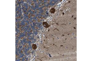 Immunohistochemical staining (Formalin-fixed paraffin-embedded sections) of human celebellum with TOMM70A polyclonal antibody  shows strong cytoplasmic positivity in Purkinje cells, cells in the granular and molecular layer. (TOM70 抗体  (AA 383-512))