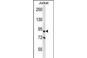 Western blot analysis in Jurkat cell line lysates (35ug/lane). (ZNF780B 抗体  (N-Term))