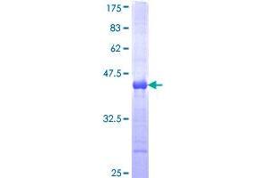 Image no. 1 for Transglutaminase 2 (C Polypeptide, Protein-Glutamine-gamma-Glutamyltransferase) (TGM2) (AA 1-120) protein (GST tag) (ABIN1322638)