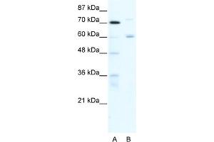 WB Suggested Anti-FOXJ2 Antibody Titration:  0. (Forkhead Box J2 抗体  (N-Term))
