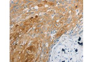 Immunohistochemistry (IHC) image for anti-Endothelin Receptor Type B (EDNRB) (AA 1-100) antibody (ABIN1679650)