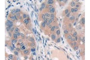 Immunohistochemistry (IHC) image for anti-Sirtuin 4 (SIRT4) (AA 28-314) antibody (ABIN7435928)