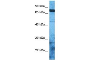 Host:  Rabbit  Target Name:  ZSC12  Sample Type:  RPMI-8226 Whole Cell lysates  Antibody Dilution:  1. (ZSC12 抗体  (N-Term))