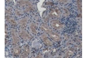 Detection of HIF1a in Porcine Kidney Tissue using Polyclonal Antibody to Hypoxia Inducible Factor 1 Alpha (HIF1a) (HIF1A 抗体  (AA 585-824))
