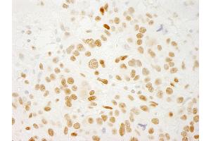Immunohistochemistry (IHC) image for anti-Protein Quaking (QKI) (C-Term), (Isoform 5) antibody (ABIN7448749) (QKI 抗体  (C-Term, Isoform 5))
