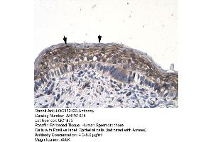 Human Spermatophore (JMJD8 抗体  (Middle Region))