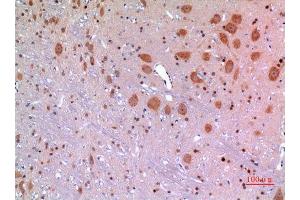 Immunohistochemistry (IHC) analysis of paraffin-embedded Rat Brain, antibody was diluted at 1:100. (MANF 抗体  (Internal Region))