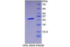 SDS-PAGE analysis of Human Protease, Serine 1 Protein. (Protease (Ser1) 蛋白)