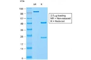 SDS-PAGE Analysis of Purified CHGA Mouse Recombinant Monoclonal Antibody ABIN6383803. (Recombinant Chromogranin A 抗体)