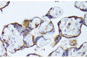 Immunohistochemistry (Paraffin-embedded Sections) (IHC (p)) image for anti-Tubulin Folding Cofactor B (TBCB) antibody (ABIN7256748)