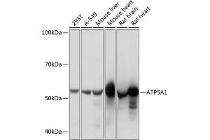Western blot analysis of extracts of various cell lines, using  Rabbit mAb (1217) at 1:1000 dilution. (ATP5A1 抗体)