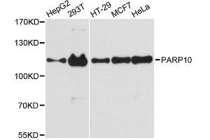 Western blot analysis of extracts of various cell lines, using PARP10 antibody. (PARP10 抗体  (AA 1-300))