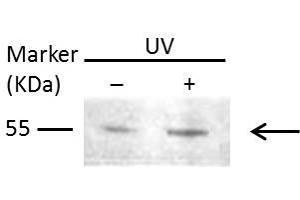 WB Image Sample (30 ug of whole cell lysate) A: Raji 10% SDS PAGE antibody diluted at 1:1000 (MMP1 抗体)