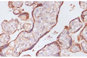 Immunohistochemistry of paraffin-embedded Human placenta using KLKB1 Polyclonal Antibody at dilution of 1:100 (40x lens). (KLKB1 抗体)