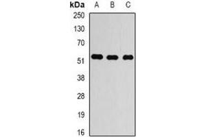 Western blot analysis of Alpha-tubulin 4a expression in LOVO (A), HEK293T (B), HUVEC (C) whole cell lysates. (TUBA4A 抗体)