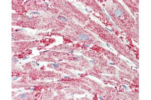 Immunohistochemistry (IHC) image for anti-Solute Carrier Family 30 (Zinc Transporter), Member 1 (SLC30A1) (AA 281-330) antibody (ABIN6752964)