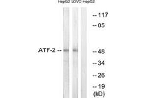 Western blot analysis of extracts from HepG2/LOVO cells, using ATF2 (Ab-69 or 51) Antibody. (ATF2 抗体  (AA 35-84))