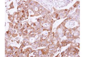IHC-P Image Immunohistochemical analysis of paraffin-embedded H441 xenograft, using UFD1L, antibody at 1:500 dilution. (UFD1L 抗体  (full length))