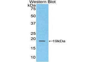 Western blot analysis of the recombinant protein. (CD97 抗体  (AA 32-173))