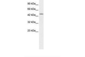 Image no. 1 for anti-Transcription Elongation Factor B (SIII), Polypeptide 1 (15kDa, Elongin C) (TCEB1) (AA 34-83) antibody (ABIN6735854) (TCEB1 抗体  (AA 34-83))