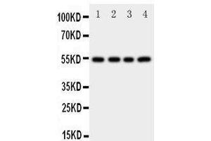 Western Blotting (WB) image for anti-Cystatin A (Stefin A) (CSTA) (AA 77-90), (C-Term) antibody (ABIN3042657) (CSTA 抗体  (C-Term))