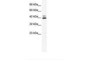 Image no. 2 for anti-Zinc Finger Protein 551 (ZNF551) (AA 169-218) antibody (ABIN203081) (ZNF551 抗体  (AA 169-218))