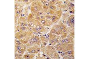 Image no. 3 for anti-Aldehyde Dehydrogenase 1 Family, Member A1 (ALDH1A1) (Center) antibody (ABIN356973)