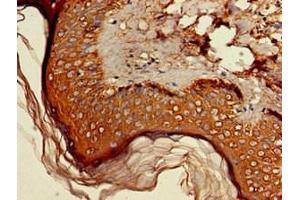 Immunohistochemistry of paraffin-embedded human skin tissue using ABIN7142284 at dilution of 1:100
