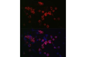 Immunofluorescence analysis of R. (CCR7 抗体  (AA 1-100))