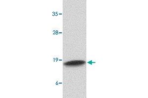 Western blot analysis of CAMP in human spleen tissue lysate with CAMP polyclonal antibody  at 1 ug/mL . (Cathelicidin 抗体  (C-Term))
